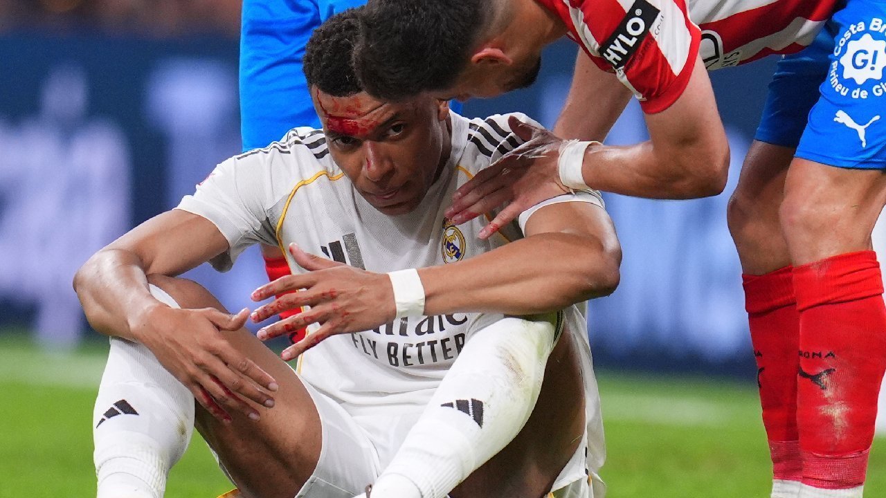 Kekalahan Real Madrid: Insiden Mbappe Berdarah dan Keheningan VAR